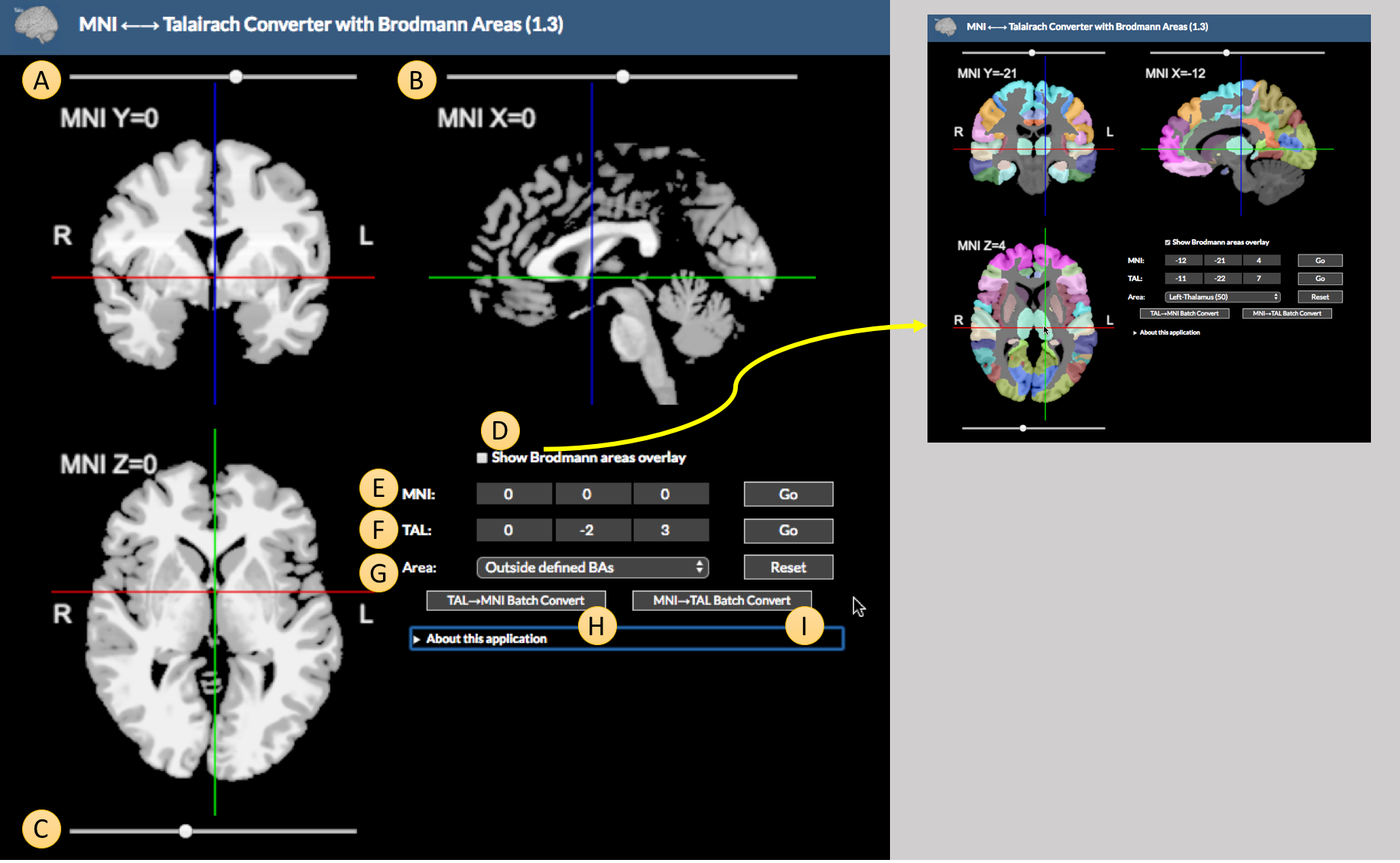 The Mni2Tal tool