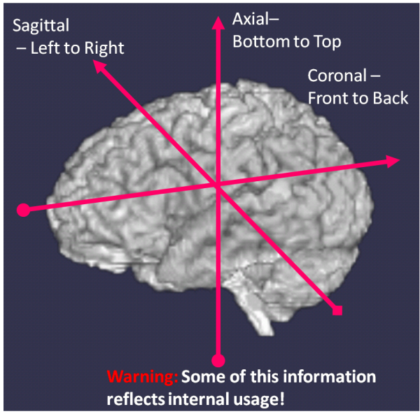 **Standard Image Acquisition Orientations, Axial or Transverse, Coronal and Sagittal.** The arrows indicate the z-axis direction (which may be inverted depending on the acquisition protocol), the x-axis and the y-axis are perpendicular to this. \textbf{Right:} Axial, coronal and sagittal slices.  Oblique acquisitions are also sometimes used, in which the z-axis is rotated, or \emph{obliqued} away from one of the standard acquisitions, e.g. coronal oblique.